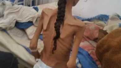 الحصار والجوع والمجاعة في اليمن